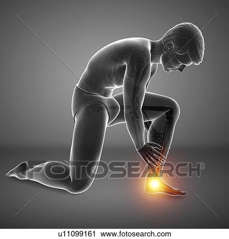 Stock Image - Man with foot pain, computer illustration.. Fotosearch