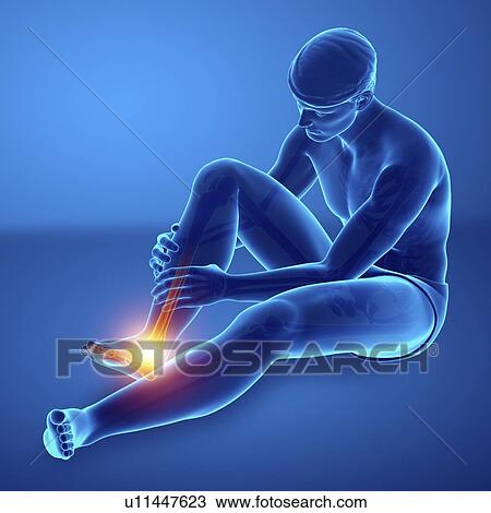 Man with foot pain, computer illustration. View Large Photo Image Stock Image - Man with foot pain, computer illustration.. Fotosearch