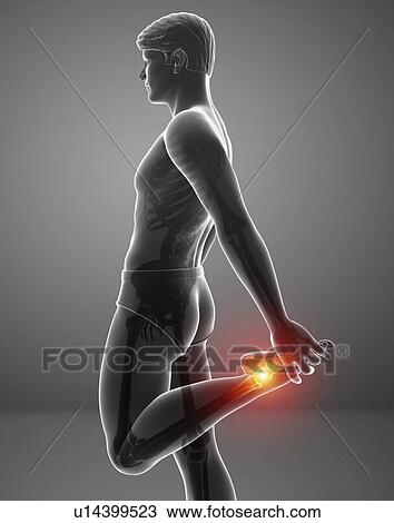 Man with foot pain, computer illustration. View Large Photo Image Stock Image - Man with foot pain, computer illustration.. Fotosearch