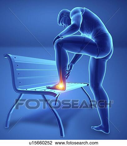 Man with foot pain, computer illustration. View Large Photo Image Stock Image - Man with foot pain, computer illustration.. Fotosearch