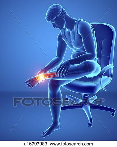 Man with foot pain, computer illustration. View Large Photo Image Stock Image - Man with foot pain, computer illustration.. Fotosearch