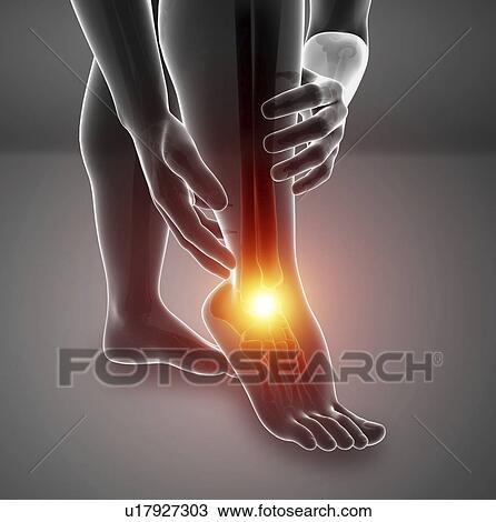 Stock Image - Man with foot pain, computer illustration.. Fotosearch