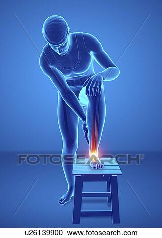 Stock Image - Man with foot pain, computer illustration.. Fotosearch