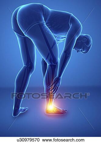 Man with foot pain, computer illustration. View Large Photo Image Stock Image - Man with foot pain, computer illustration.. Fotosearch