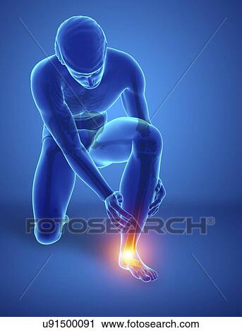 Stock Image - Man with foot pain, computer illustration.. Fotosearch