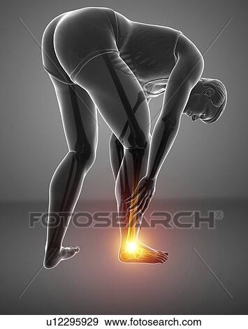 Stock Photo - Man with foot pain, computer illustration.. Fotosearch