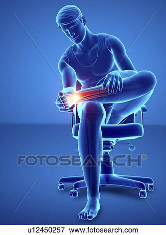 Man with foot pain, computer illustration. View Large Photo Image Stock Photo - Man with foot pain, computer illustration.. Fotosearch