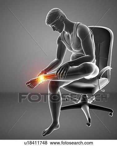 Stock Photo - Man with foot pain, computer illustration.. Fotosearch