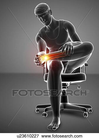 Man with foot pain, computer illustration. View Large Photo Image Stock Photo - Man with foot pain, computer illustration.. Fotosearch