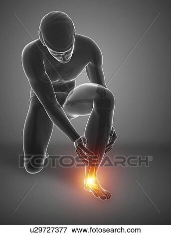 Stock Photo - Man with foot pain, computer illustration.. Fotosearch