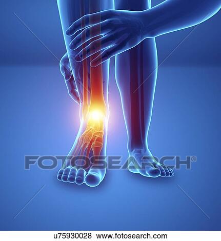 Man with foot pain, computer illustration. View Large Photo Image Stock Photo - Man with foot pain, computer illustration.. Fotosearch