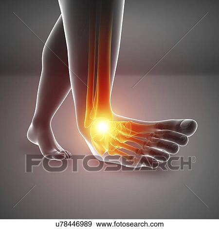 Man with foot pain, computer illustration. View Large Photo Image Stock Photo - Man with foot pain, computer illustration.. Fotosearch