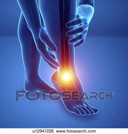 Stock Photograph - Man with foot pain, computer illustration.. Fotosearch
