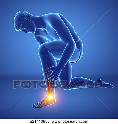 Man with foot pain, computer illustration. View Large Photo Image Stock Photography - Man with foot pain, computer illustration.. Fotosearch