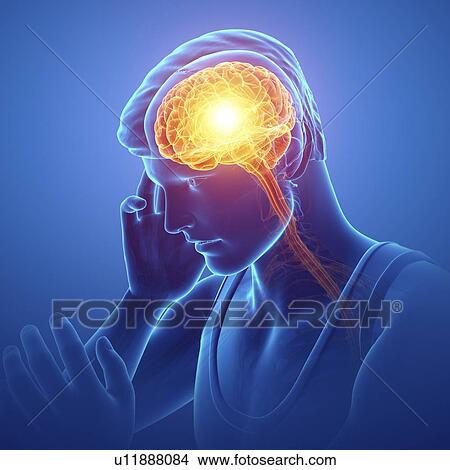 Picture - Man with headache, computer illustration.. Fotosearch