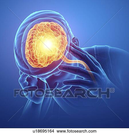 Picture - Man with headache, computer illustration.. Fotosearch