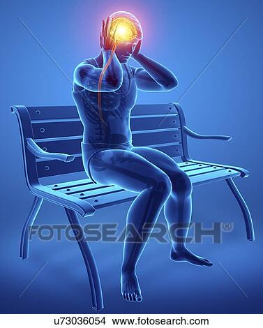 Picture - Man with headache, computer illustration.. Fotosearch