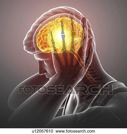 Stock Image - Man with headache, computer illustration.. Fotosearch