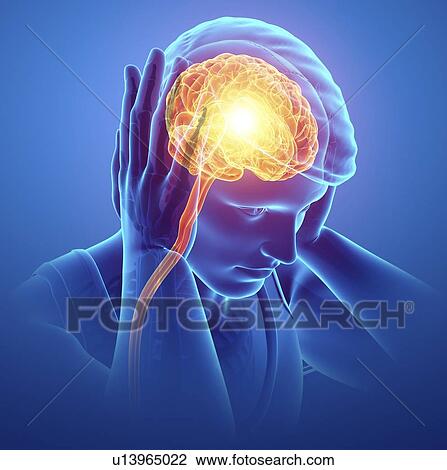 Man with headache, computer illustration. View Large Photo Image Stock Image - Man with headache, computer illustration.. Fotosearch