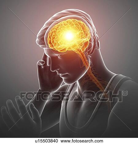 Stock Image - Man with headache, computer illustration.. Fotosearch