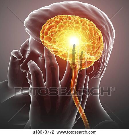Man with headache, computer illustration. View Large Photo Image Stock Image - Man with headache, computer illustration.. Fotosearch