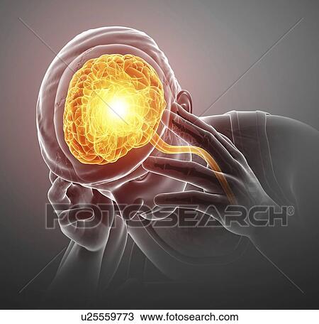 Stock Image - Man with headache, computer illustration.. Fotosearch
