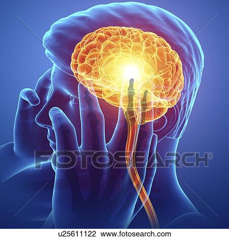 Man with headache, computer illustration. View Large Photo Image Stock Image - Man with headache, computer illustration.. Fotosearch