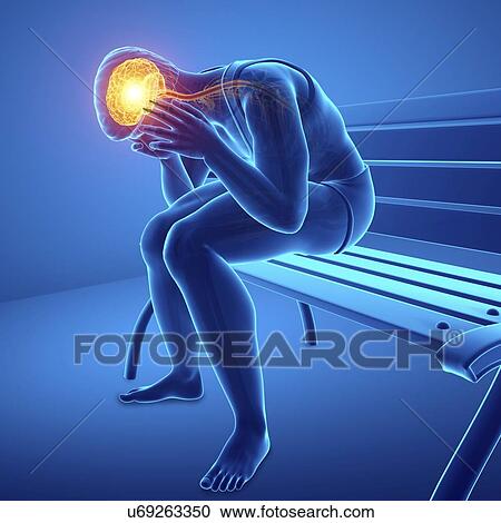 Stock Image - Man with headache, computer illustration.. Fotosearch