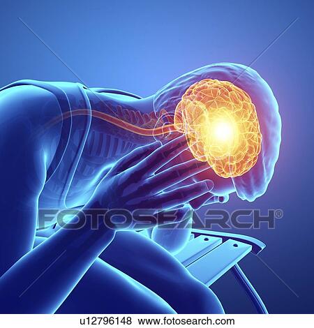 Man with headache, computer illustration. View Large Photo Image Stock Photo - Man with headache, computer illustration.. Fotosearch