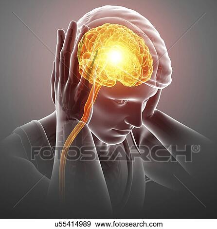 Stock Photo - Man with headache, computer illustration.. Fotosearch