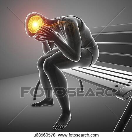Stock Photo - Man with headache, computer illustration.. Fotosearch
