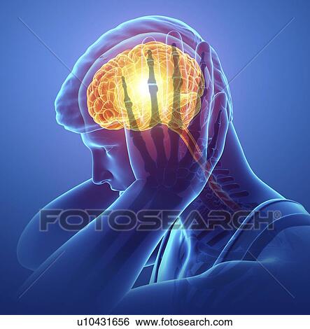 Stock Photograph - Man with headache, computer illustration.. Fotosearch