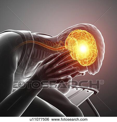 Stock Photograph - Man with headache, computer illustration.. Fotosearch