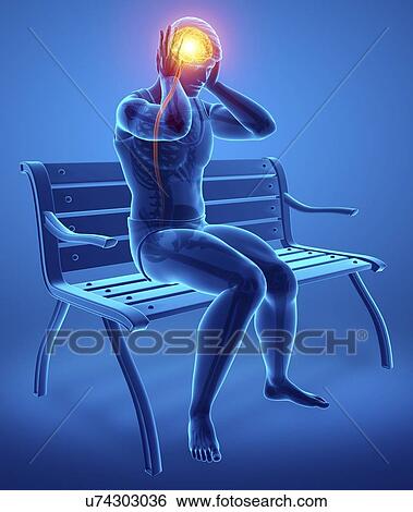 Man with headache, computer illustration. View Large Photo Image Stock Photograph - Man with headache, computer illustration.. Fotosearch