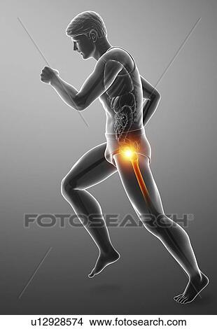 Man with hip pain, computer illustration. View Large Photo Image Picture - Man with hip pain, computer illustration.. Fotosearch