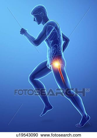 Stock Image - Man with hip pain, computer illustration.. Fotosearch