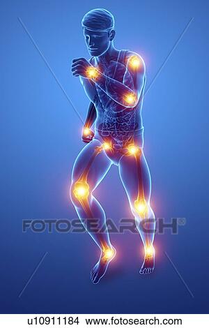 Picture - Man with joint pain, computer illustration.. Fotosearch