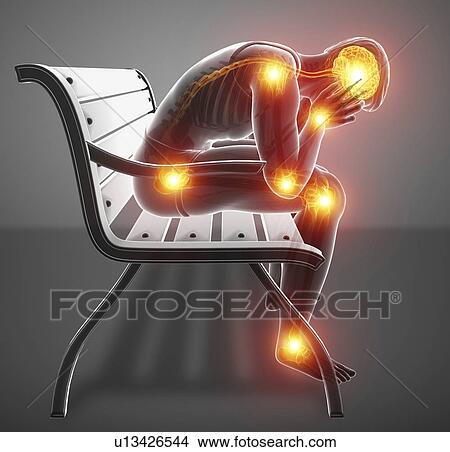Man with joint pain, computer illustration. View Large Photo Image Picture - Man with joint pain, computer illustration.. Fotosearch