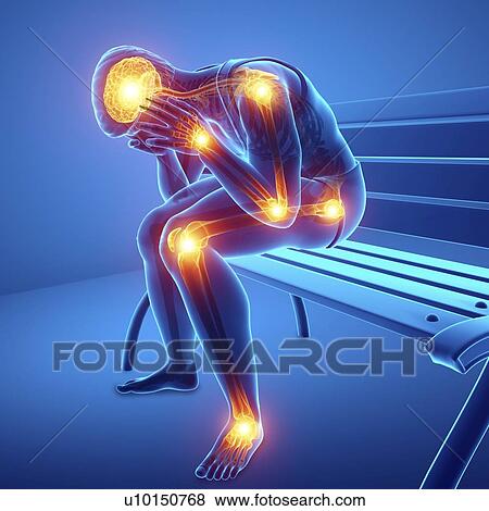 Stock Photo - Man with joint pain, computer illustration.. Fotosearch