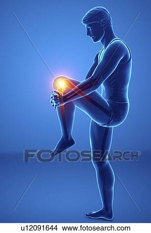 Man with knee pain, computer illustration. View Large Photo Image Picture - Man with knee pain, computer illustration.. Fotosearch