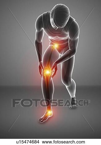 Man with knee pain, computer illustration. View Large Photo Image Picture - Man with knee pain, computer illustration.. Fotosearch