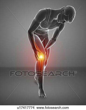 Picture - Man with knee pain, computer illustration.. Fotosearch