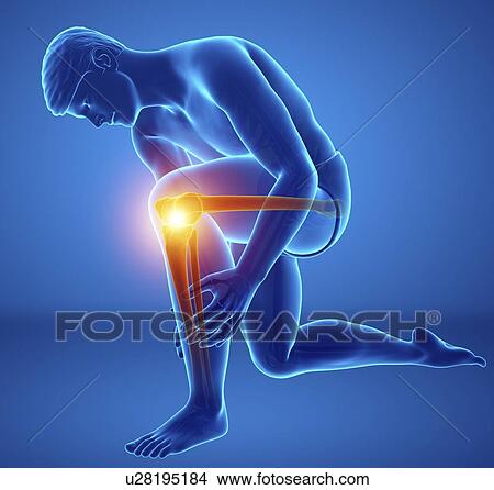 Picture - Man with knee pain, computer illustration.. Fotosearch