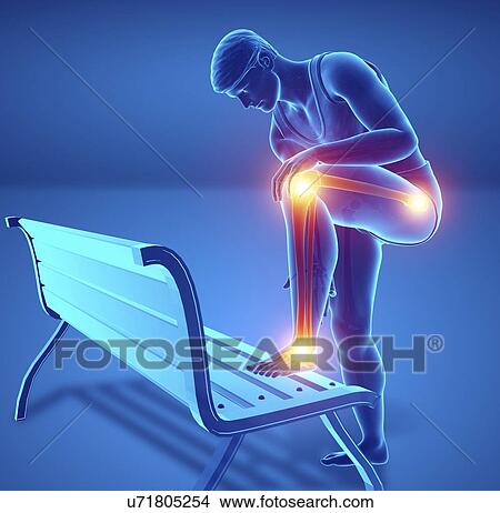 Picture - Man with knee pain, computer illustration.. Fotosearch