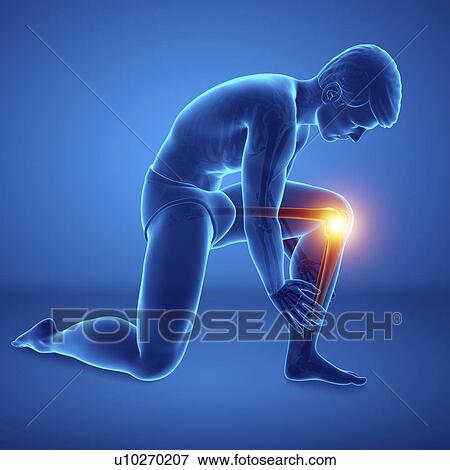 Stock Photo - Man with knee pain, computer illustration.. Fotosearch