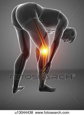Stock Photo - Man with knee pain, computer illustration.. Fotosearch