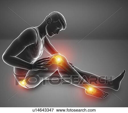 Stock Photo - Man with knee pain, computer illustration.. Fotosearch