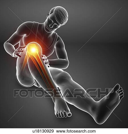 Stock Photo - Man with knee pain, computer illustration.. Fotosearch
