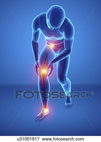 Stock Photo - Man with knee pain, computer illustration.. Fotosearch