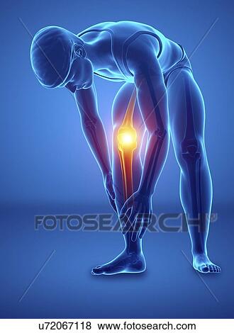 Stock Photo - Man with knee pain, computer illustration.. Fotosearch